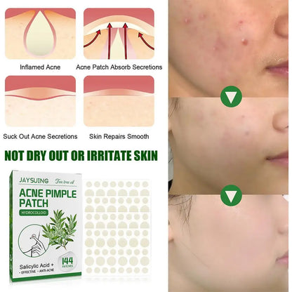 144patch Acne Pimple Patches Translucent Matte Hydrocolloid Salicylic Acid Tea Tree Oil For Inflamed Acne Improve Whiteheads