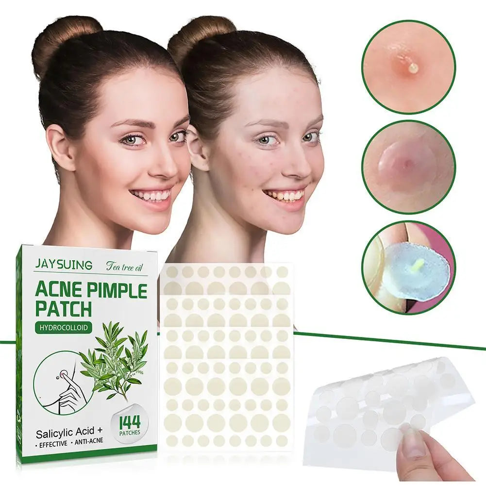 144patch Acne Pimple Patches Translucent Matte Hydrocolloid Salicylic Acid Tea Tree Oil For Inflamed Acne Improve Whiteheads